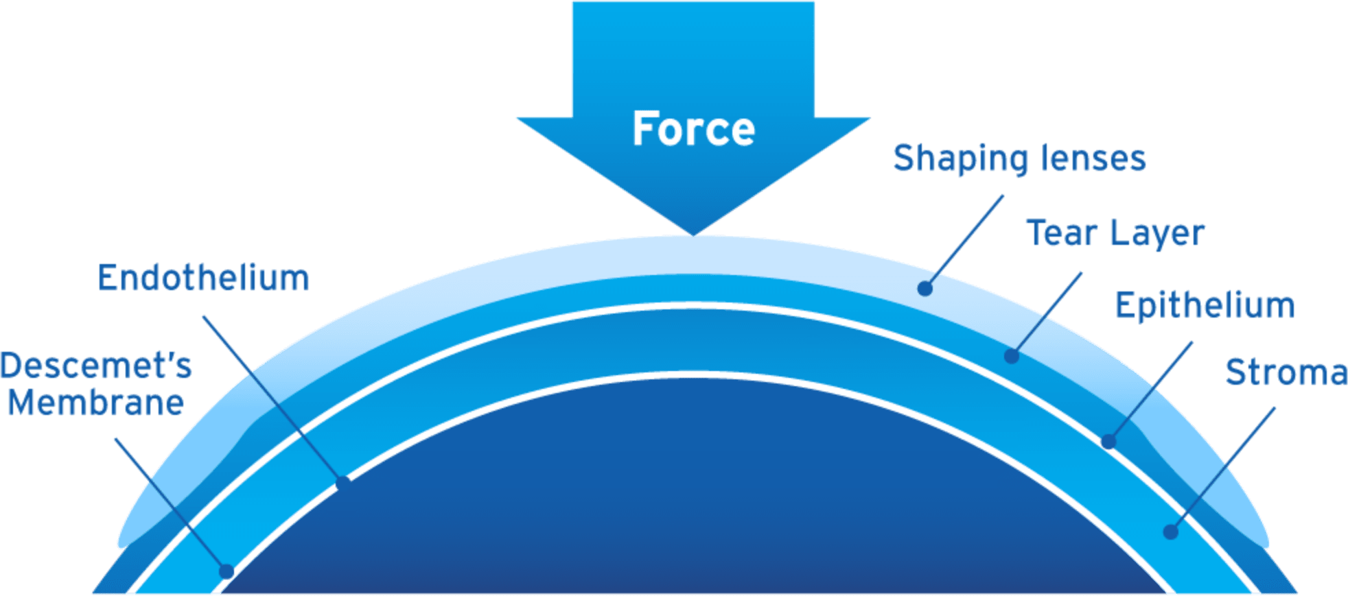 ortho-k-Boston-visual